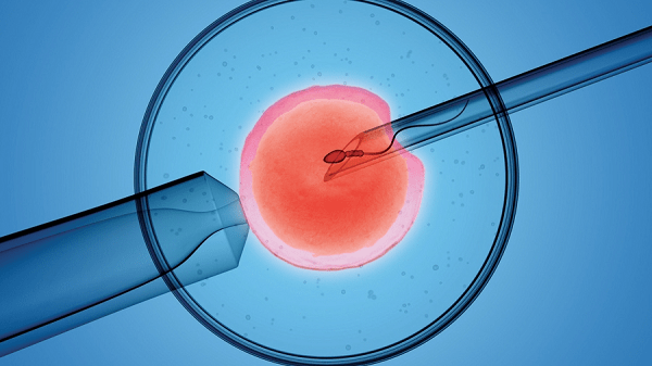 Procédures de fécondation in vitro
